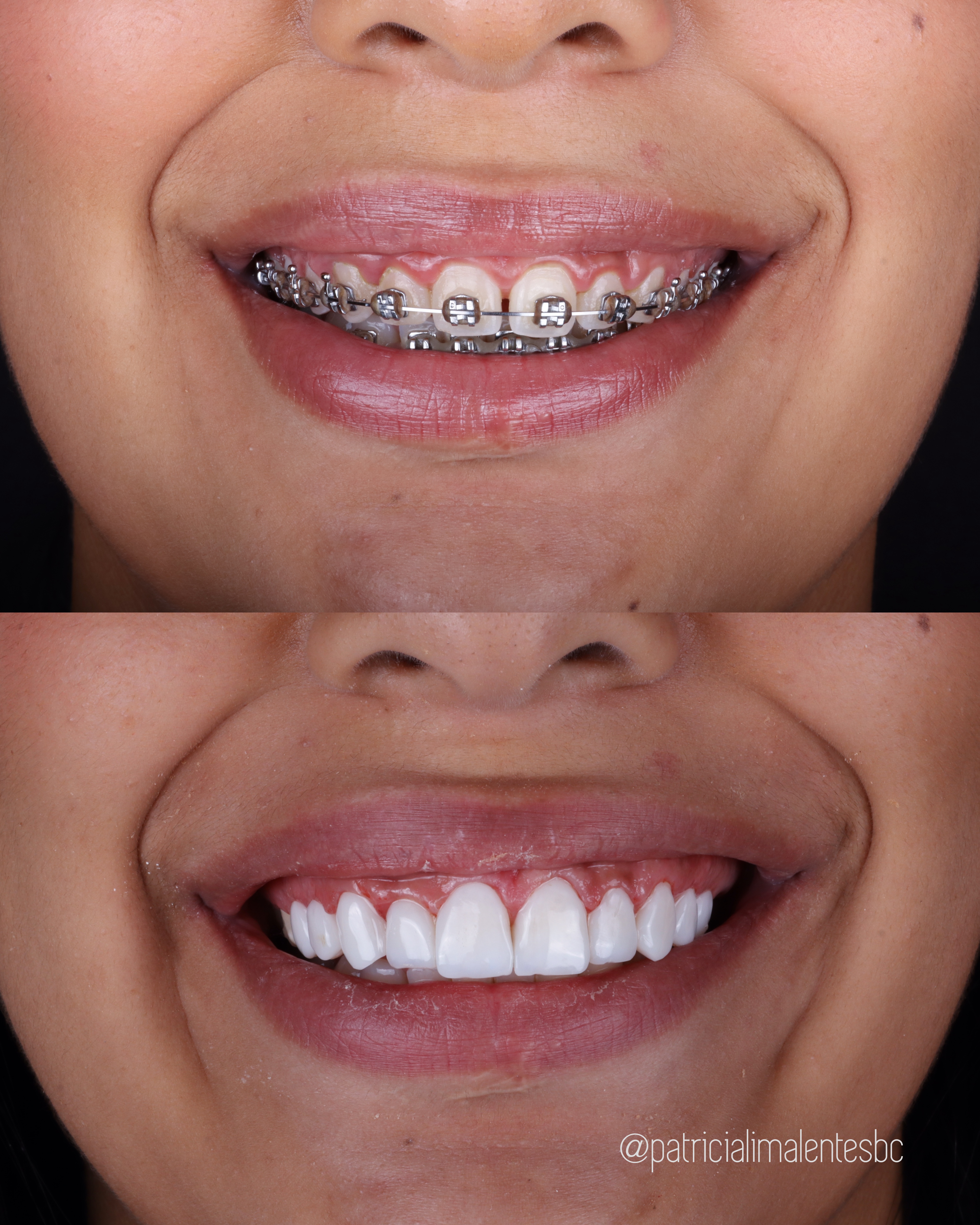 Antes e Depois 8